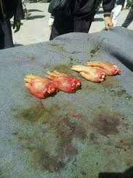 قطع کردن دست جوان سوری توسط داعش جنایتی برخلاف سنت اسلام +تصویر 
